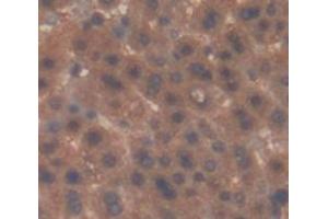 Immunohistochemistry (IHC) image for anti-Orosomucoid 1 (ORM1) (AA 19-186) antibody (ABIN1857833)