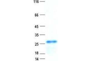 Validation with Western Blot (DNAJB6 Protein (His tag))