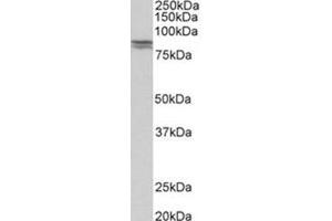 AP31777PU-N CDH1 antibody staining of Human kidney lysate at 0. (E-cadherin 抗体  (Internal Region))
