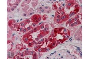 Image no. 1 for anti-Midline 2 (MID2) (C-Term) antibody (ABIN374299) (Midline 2 抗体  (C-Term))