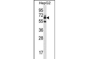 GGT2 Antibody (N-term) (ABIN656774 and ABIN2845993) western blot analysis in HepG2 cell line lysates (35 μg/lane). (gGT2 抗体  (N-Term))