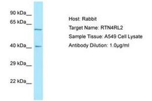 Image no. 1 for anti-Reticulon 4 Receptor-Like 2 (RTN4RL2) (C-Term) antibody (ABIN6750022) (RTN4RL2 抗体  (C-Term))