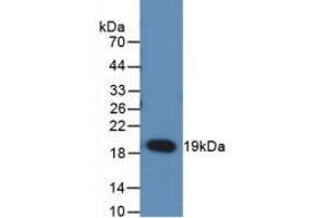 Western blot analysis of recombinant Rat RANkL. (RANKL 抗体  (AA 106-240))