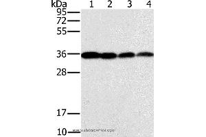Western blot analysis of Raji, Jurkat, 293T and hela cell, using CENPV Polyclonal Antibody at dilution of 1:200 (CENPV 抗体)
