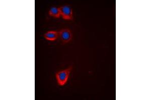 Immunofluorescence (IF) image for anti-B-Cell CLL/lymphoma 2 (BCL2) (Center) antibody (ABIN7301506)
