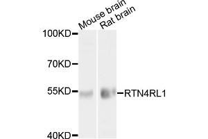 Western blot analysis of extracts of various cell lines, using RTN4RL1 antibody (ABIN6003728) at 1/1000 dilution. (RTN4RL1 抗体)