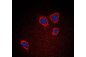 Immunofluorescent analysis of Caveolin 1 staining in A431 cells. (Caveolin-1 抗体  (C-Term))