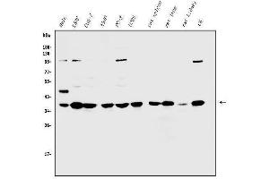 Western blot analysis of Annexin A1/ANXA1 using anti-Annexin A1/ANXA1 antibody (ABIN3043783). (Annexin a1 抗体  (AA 2-346))