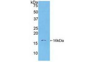 Detection of Recombinant S100A6, Human using Polyclonal Antibody to S100 Calcium Binding Protein A6 (S100A6) (S100A6 抗体  (AA 1-90))