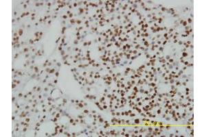 Image no. 1 for anti-Zinc Finger Protein 143 (ZNF143) (AA 1-627) antibody (ABIN466122) (ZNF143 抗体  (AA 1-627))