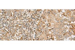 Immunohistochemistry (Paraffin-embedded Sections) (IHC (p)) image for anti-Zinc Finger CCCH-Type Containing 7A (ZC3H7A) antibody (ABIN7252777)