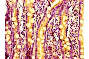 Immunohistochemistry of paraffin-embedded human small intestine tissue using ABIN7143085 at dilution of 1:100 (ARPC2 抗体  (AA 1-250))