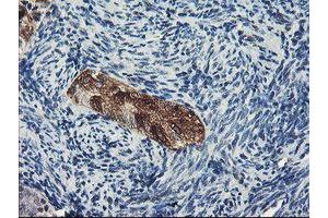 Immunohistochemistry (IHC) image for anti-Dipeptidyl-Peptidase 8 (DPP8) antibody (ABIN1497835) (DPP8 抗体)