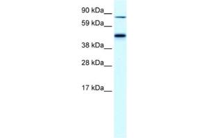 Western Blotting (WB) image for anti-erythrocyte Membrane Protein Band 4.2 (EPB42) antibody (ABIN2460809) (EPB42 抗体)