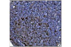 IHC analysis of FABP-1/GOT2 using anti-FABP-1/GOT2 antibody (ABIN7601426). (GOT2 抗体  (AA 35-430))