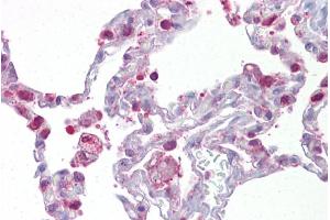 Immunohistochemistry with Lung tissue at an antibody concentration of 5µg/ml using anti-PGDS antibody (ARP48763_P050) (PTGDS 抗体  (N-Term))