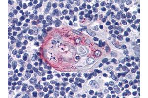 Immunohistochemical analysis of paraffin-embedded human Thymus tissues using anti-AKT2 mAb (AKT2 抗体)