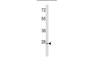 Western blot analysis of ARHE Antibody (Center)(Cat. (RND3 抗体  (AA 133-165))
