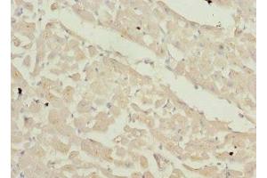 Immunohistochemistry of paraffin-embedded human heart tissue using ABIN7176063 at dilution of 1:100 (ZFYVE16 抗体  (AA 1-280))