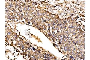 IHC analysis of ORP150/HYOU1 using anti-ORP150/HYOU1 antibody (ABIN7601807). (HYOU1 抗体  (AA 46-913))
