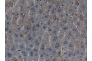 Detection of ADAMTS2 in Mouse Liver Tissue using Polyclonal Antibody to A Disintegrin And Metalloproteinase With Thrombospondin 2 (ADAMTS2)