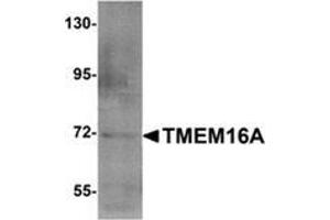 Western blot analysis of TMEM16A (arrow) in A549 cell lysate with TMEM16A Antibody  at 1 μg/ml. (ANO1 抗体  (N-Term))