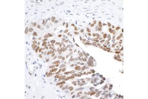 Immunohistochemistry (IHC) image for anti-H2A Histone Family, Member X (H2AFX) (C-Term) antibody (ABIN7449536) (H2AFX 抗体  (C-Term))