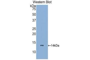 Western blot analysis of recombinant Human GCSFR. (CSF3R 抗体  (AA 26-138))