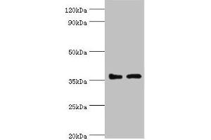 Western blot All lanes: BRCC3 antibody at 3 μg/mL Lane 1: 293T whole cell lysate Lane 2: MCF-7 whole cell lysate Secondary Goat polyclonal to rabbit IgG at 1/10000 dilution Predicted band size: 37, 34, 24, 29 kDa Observed band size: 37 kDa (BRCC3 抗体  (AA 1-316))