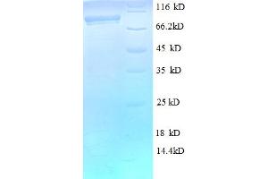 SDS-PAGE (SDS) image for DEAD (Asp-Glu-Ala-Asp) Box Polypeptide 27 (DDX27) (AA 30-794), (partial) protein (His-SUMO Tag) (ABIN5711559) (DDX27 Protein (AA 30-794, partial) (His-SUMO Tag))