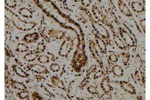 ABIN6276587 at 1/100 staining Human kidney tissue by IHC-P. (PML 抗体  (N-Term))