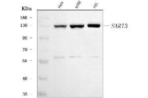 Western blot analysis of SART3 using anti-SART3 antibody (ABIN7600151).
