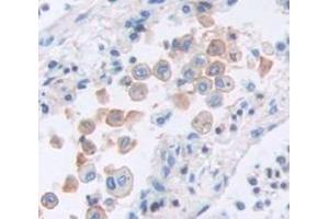 Immunohistochemistry (Paraffin-embedded Sections) (IHC (p)) image for anti-Lysyl Oxidase-Like 2 (LOXL2) (AA 323-427) antibody (ABIN2938096)
