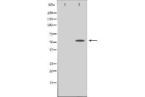 Western blot analysis of extracts from COLO cells using PPHLN antibody. (PPHLN1 抗体  (N-Term))