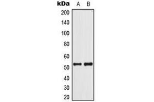 Western blot analysis of p53 (pS37) expression in COLO205 (A), Jurkat UV-treated (B) whole cell lysates. (p53 抗体  (N-Term, pSer37))