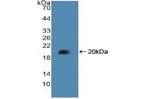 Western blot analysis of recombinant Human PPARd. (PPARD 抗体  (AA 260-426))