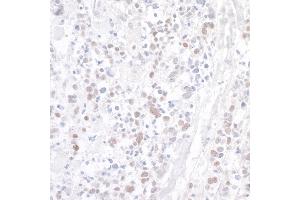 anti-WD Repeat Containing, Antisense To TP53 (WRAP53) (AA 1-50) antibody