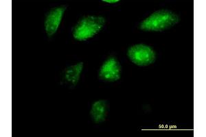 Immunofluorescence of monoclonal antibody to SETDB1 on HeLa cell. (SETDB1 抗体  (AA 2-100))