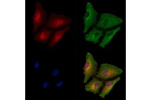 ABIN6258032 and ABIN6275061 staining  cells by IF/ICC. (DPYSL4 抗体  (Internal Region))