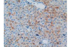 IHC-P analysis of Mouse Liver Tissue, with DAB staining. (MAPT 抗体  (AA 92-400))