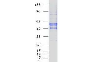 Solute Carrier Family 2 (Facilitated Glucose/fructose Transporter), Member 5 (SLC2A5) (Transcript Variant 1) protein (Myc-DYKDDDDK Tag)