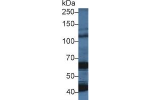 Western Blot; Sample: Porcine Cerebrum lysate; Primary Ab: 5µg/ml Rabbit Anti-Human OAS1 Antibody Second Ab: 0. (OAS1 抗体  (AA 74-165))
