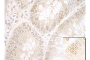 Immunohistochemistry (IHC) image for anti-Nuclear Protein, Ataxia-Telangiectasia Locus (NPAT) (AA 700-750) antibody (ABIN7453506)