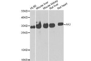 Western blot analysis of extracts of various cell lines, using AK2 antibody (ABIN5973904) at 1/1000 dilution. (Adenylate Kinase 2 抗体)