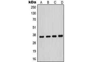 Western blot analysis of MNAT1 expression in HeLa (A), MCF7 (B), A431 (C), NIH3T3 (D) whole cell lysates. (MNAT1 抗体  (Center))