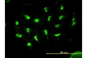 Immunofluorescence of monoclonal antibody to HDAC11 on HeLa cell. (HDAC11 抗体  (AA 1-347))