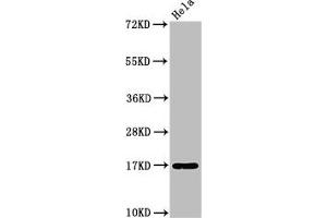 Western Blot Positive WB detected in: Hela whole cell lysate All lanes: C1D antibody at 3. (C1D 抗体  (AA 1-135))