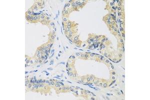 Immunohistochemistry of paraffin-embedded human prostate using UPF2 antibody. (RENT2/UPF2 抗体  (AA 1153-1272))