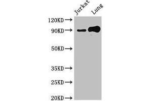 Western Blot Positive WB detected in: Jurkat whole cell lysate, Mouse lung tissue All lanes: STAT5B antibody at 2. (STAT5B 抗体  (AA 40-280))