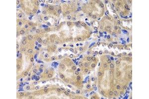 Immunohistochemistry of paraffin-embedded Mouse kidney using RPL5 Polyclonal Antibody at dilution of 1:200 (40x lens). (RPL5 抗体)